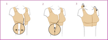 Load image into Gallery viewer, ABC Post Surgical Compression Bra
